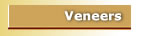 bonded veneers