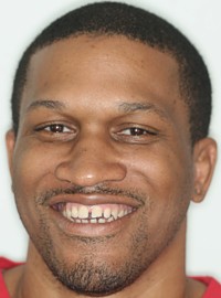 Broken Anterior Enamel