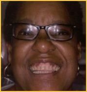 Black Female Dark Gingival Excess Pigmentation