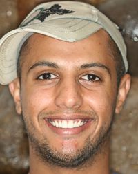 New Pink Gums with New Porcelain Veneers Pictures